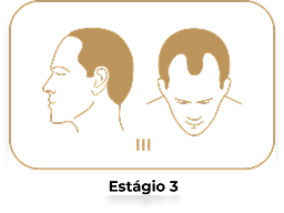 Estágio 3