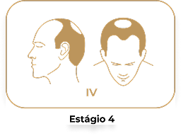 Estágio 4