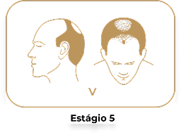 Estágio 5