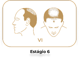 Estágio 6