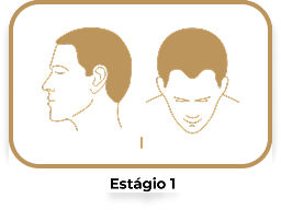 Estágio 1